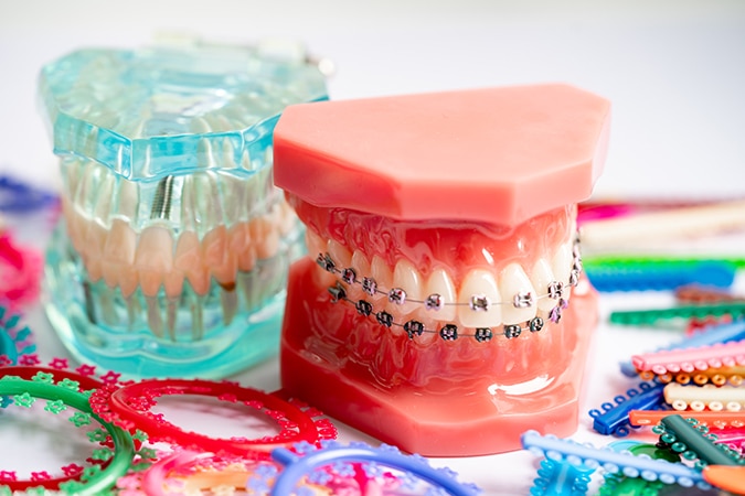 Orthodontic Treatment Alternatives and Insurance Coverage