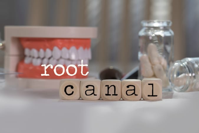 root-canals-explained-