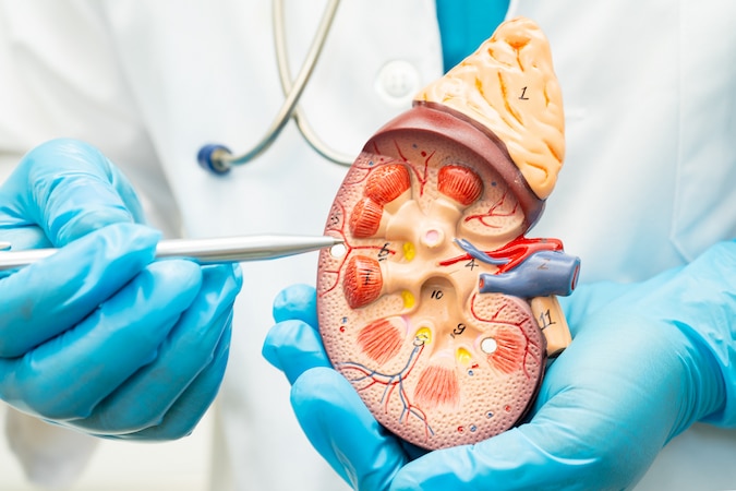 avoid-kidney-stones